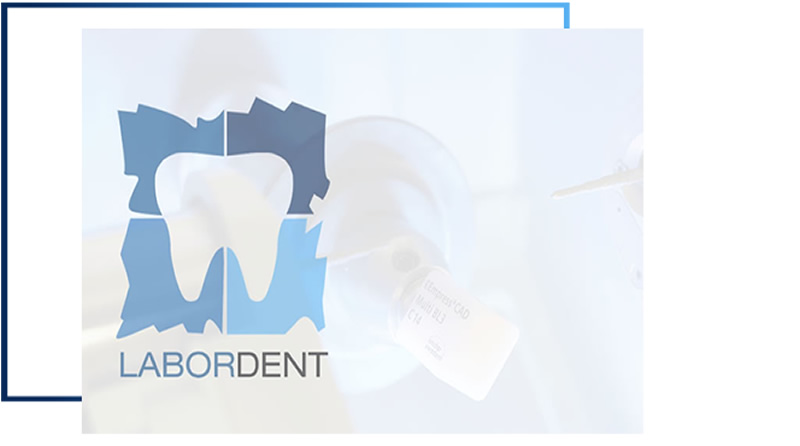 Personalización de prótesis hibridas